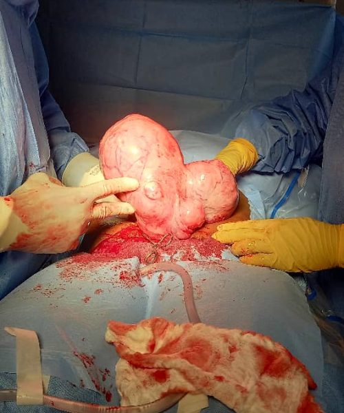 KBB volunteer surgeons performing operations at Olabisi Onabanjo University Teaching Hospital, 2025